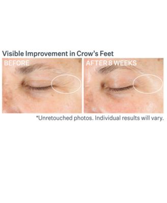 Advanced Retinol Multi-Correct Eye Cream