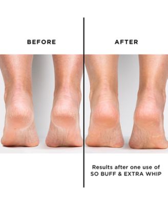 Jumbo Extra Whip Hand & Foot Treatment With Shea Butter, 7 oz.