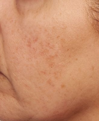 Vitamin C Ester Intensive Dark Spot Treatment, 1 oz. 