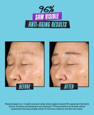 Super Multi-Corrective Anti-Aging Face & Neck Soft Cream, 2.5 oz.