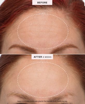 That Overnight Hustle AHA + BHA Resurfacer