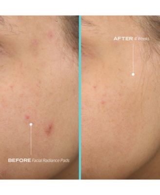 Facial Radiance Pads with Glycolic + Lactic Acids – Exfoliating Pads with AHA, 28 pads