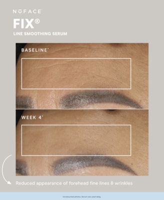 FIX&reg; Serum, .5 oz. 