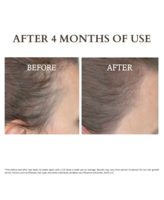 Anti Hair Loss Pre Shampoo Treatment Serum
