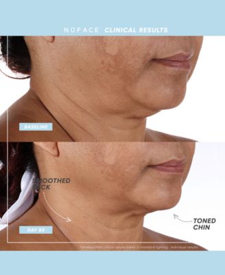 6-Pc. Trinity+ Complete Toning Set