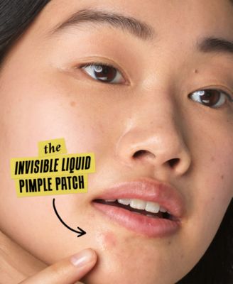 Truly Targeted Acne-Clearing Solution