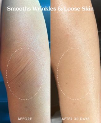 Ultra Renewal Retinol Body Cream, 4.7 oz.