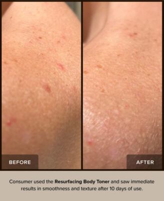 NUDEBODY Resurfacing Body Toner, 5.07 oz.