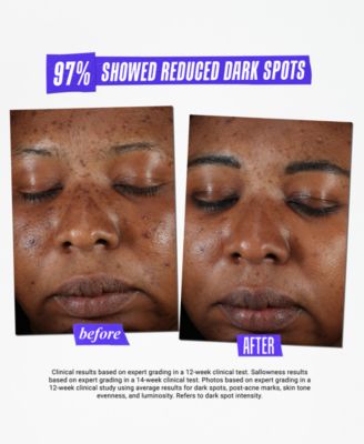 Dermatologist Solutions Clearly Corrective Dark Spot Solution, 3.4-oz.