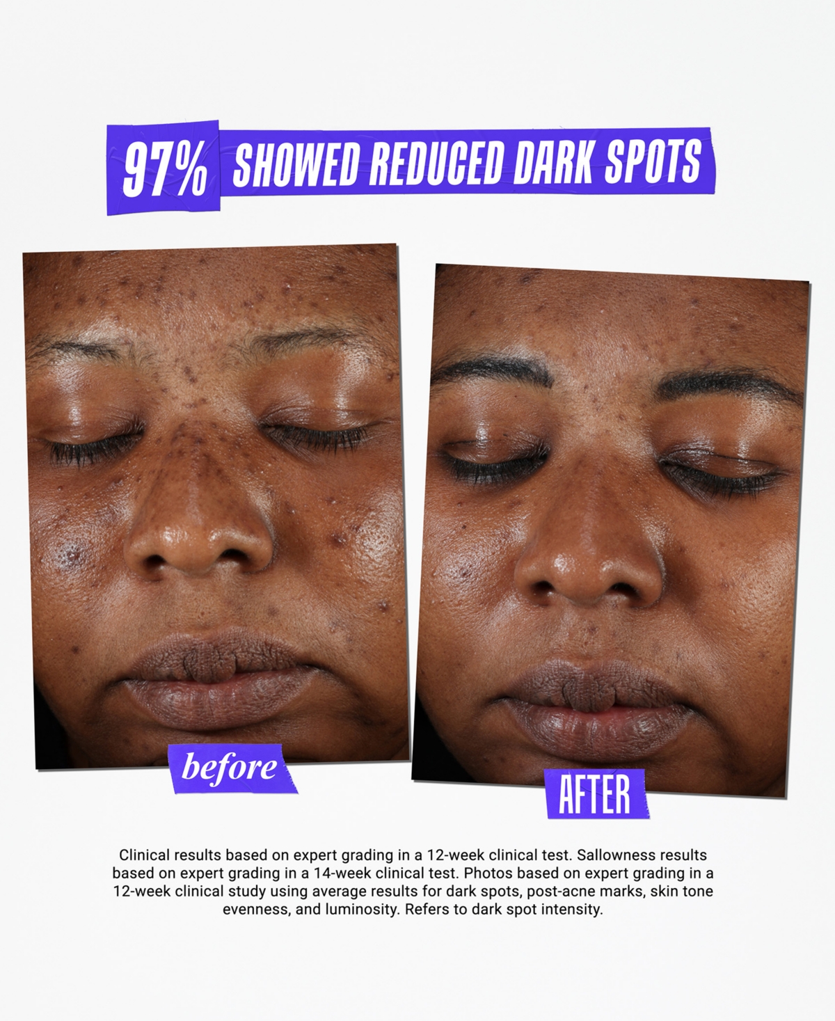 Kiehl's Since 1851 Dermatologist Solutions Clearly Corrective Dark Spot Solution, 3.4-oz