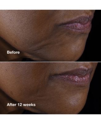 Smart Clinical Repair Lifting Face + Neck Cream, 1.7 oz.