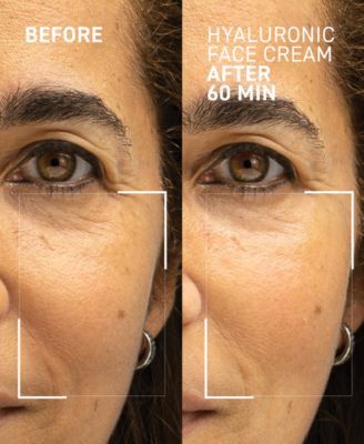 Needles No More Hyaluronic Face Cream, 1.7 oz. 