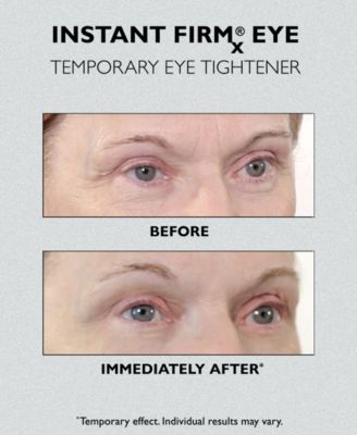 Instant FIRMx&reg; Eye Temporary Eye Tightener, 1.0 fl. oz. 