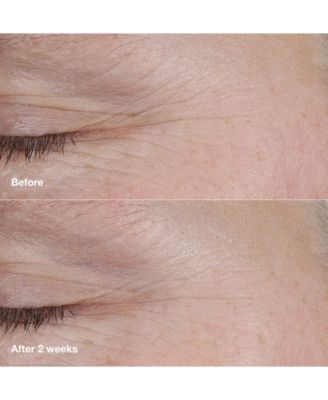 Smart Clinical Repair AM/PM Retinoid Balm, 0.12 oz