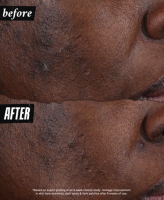 Auto-Tone Discoloration & UV Solution, 1.4 oz.