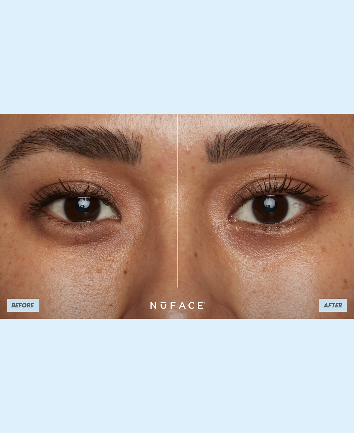 Shop Nuface Ionplex Power Patches In No Color