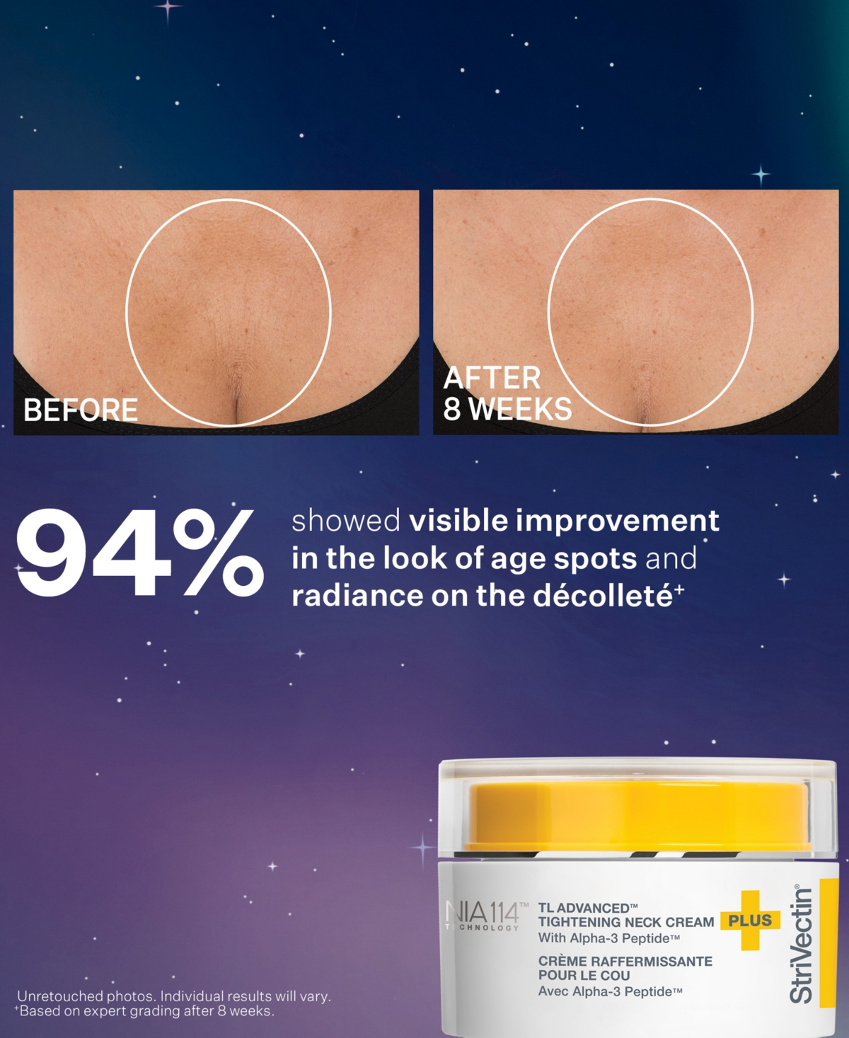 StriVectin 2-Pc. Tighten & Sculpt Skincare Set