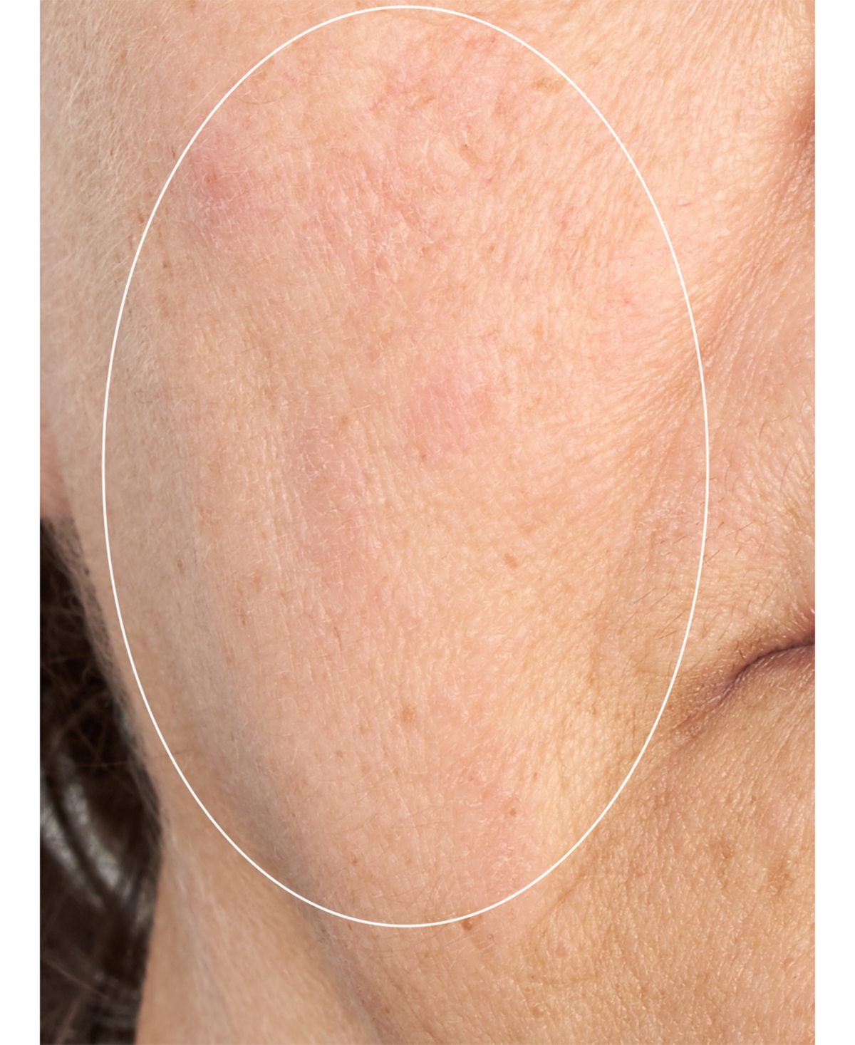 Perricone Md Hp Intensive Smoothing Serum, 2.0 oz In No Color