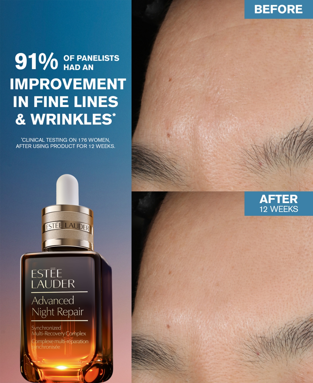 Estée Lauder Limited-edition Advanced Night Repair Serum In No Color