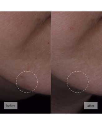 Hope In A Jar Smooth-Glow Multi-Tasking Moisturizer With Pro-Vitamin P, Glycolic & Hyaluronic Acids, 4 oz.