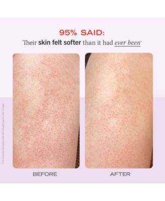 KP Bump Eraser Body Scrub With 10% AHA - Fresh Strawberry, 8 oz.