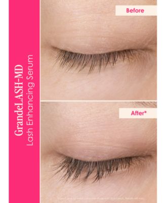 2-Pc. Lash System Set