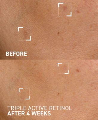Triple Active Retinol Gentle Overnight Renewal Cream, 1 oz.