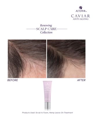 Renewing Scalp Care Hemp Leave-On Treatment, 2.5 oz.