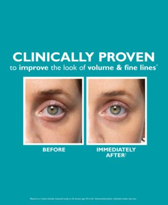 Peptide Skinjection Fill + Fix Under-Eye Cream, 0.5 oz.