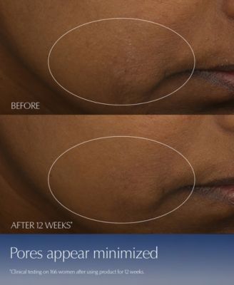 Advanced Night Repair Duo Synchronized Multi-Recovery Complex Serum with Hyaluronic Acid & Peptides, 1.7 oz Duo