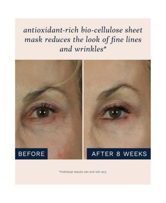 Bio-Cellulose Sheet Face Mask, 0.84 Fl Oz/25 Ml