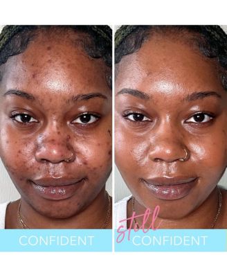 Liquid Filter Foundation with Niacinamide