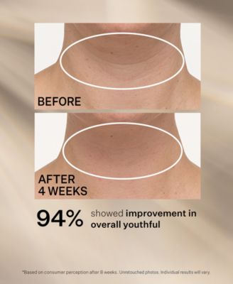 TL Advanced Tightening Neck Cream Plus With Alpha-3 Peptide, 3.4 oz.