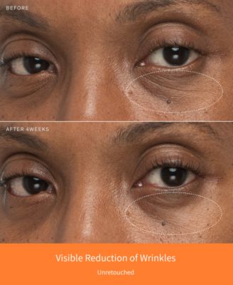 First Care Activating Serum VI, 3 oz.