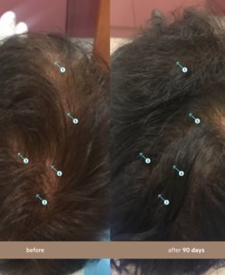 Spectral.DNC-N Hair Density Serum With Nanoxidil 5%, 3-Month Supply