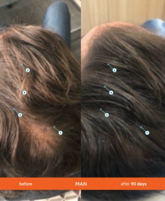 Revita High-Performance Hair Density Conditioner, 205 ml