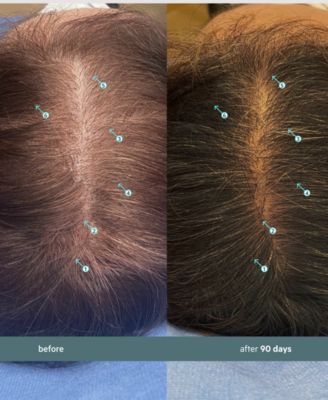 Spectral.F7 Booster With Astressin-B, 60 ml