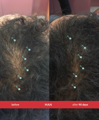 Spectral.DNC-S Extra Strength Anti-Gray Hair Density Serum, 2 oz.