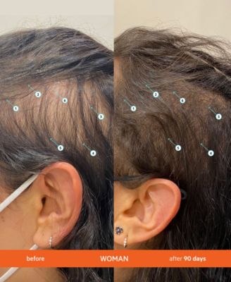 REVITA High-Performance Hair Density Shampoo, 925 ml