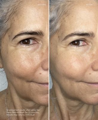 Brightening Derm-Revival Mask - 10 pack