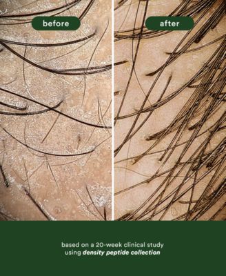 Density Peptide Shampoo, 12 oz.