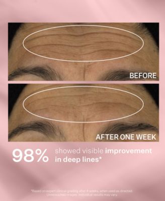 Anti-Wrinkle Wrinkle Recode Serum, 1-oz.