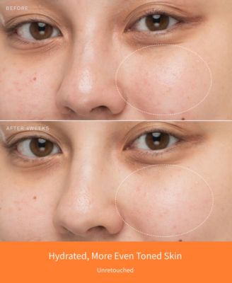 4-Pc. First Care Activating Serum VI Set