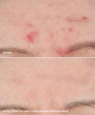 2-Pc. Vitamin Enriched Home and Away Smoothing Serum Set