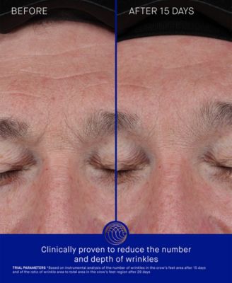 The Elixir, 1.01 oz.