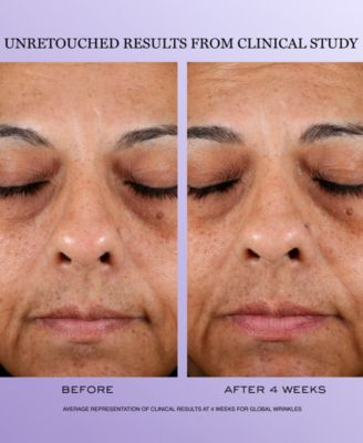 3-Pc. R&eacute;nergie H.C.F. Triple Serum Discovery Set