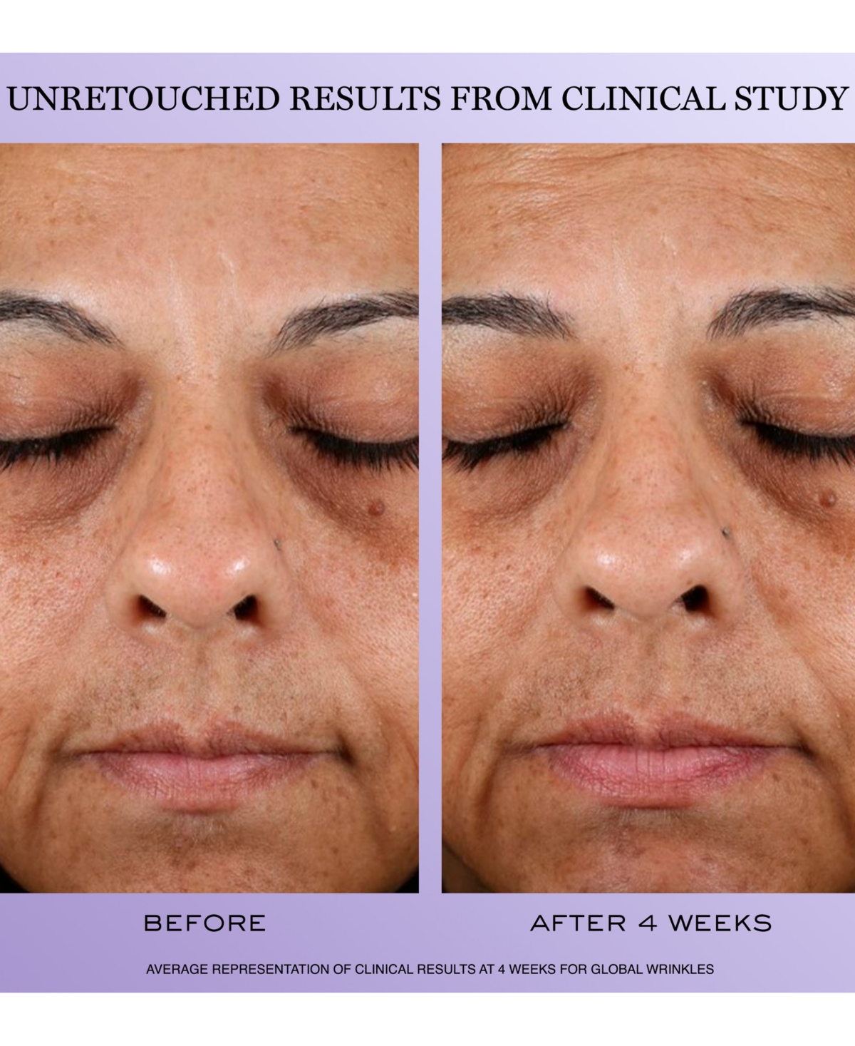 Lancome 3-Pc. Genifique Ultimate Discovery Set