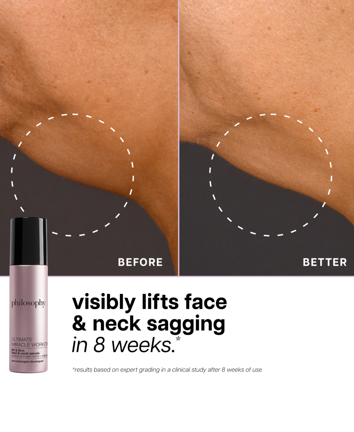 philosophy Ultimate Miracle Worker Lift and Firm Face and Neck Serum, 1.6 oz.