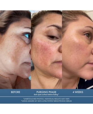 Ultra Potent Brightening Serum Dark Spot Corrector