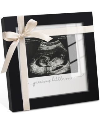 Solo Baby Sonogram Picture Frame, Modern Ultrasound Picture Frames, Pregnancy Announcements Sonogram Frame